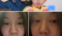 明星爆料割双眼皮视频,割双眼皮背后的真实故事